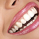 Enamel Shaping, Bleaching, Bonding & Vaneers